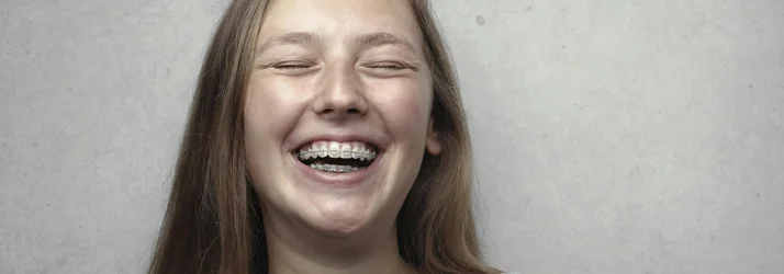 FC – Braces at NELA Orthodontics in Los Angeles CA